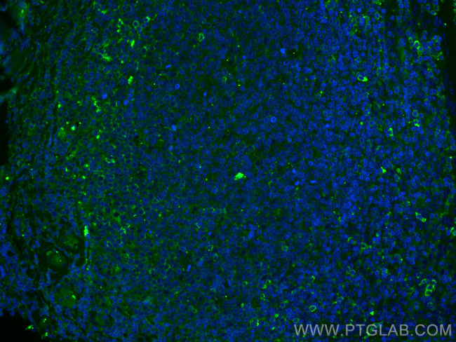CD27 Antibody in Immunohistochemistry (PFA fixed) (IHC (PFA))