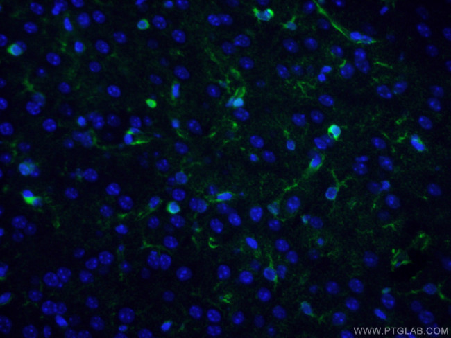 Glutamine synthetase Antibody in Immunohistochemistry (PFA fixed) (IHC (PFA))