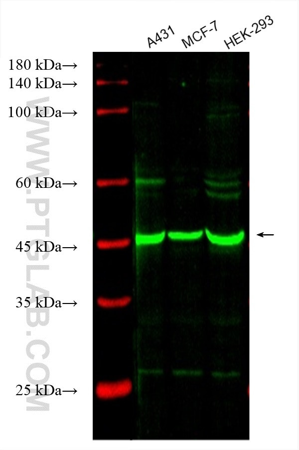 SMYD3 Antibody in Western Blot (WB)