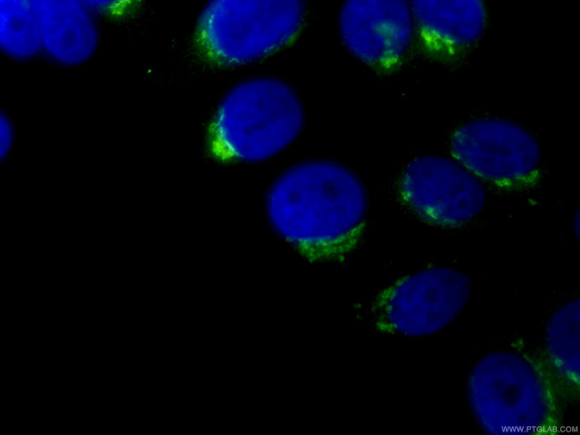 GP73/GOLPH2 Antibody in Immunocytochemistry (ICC/IF)