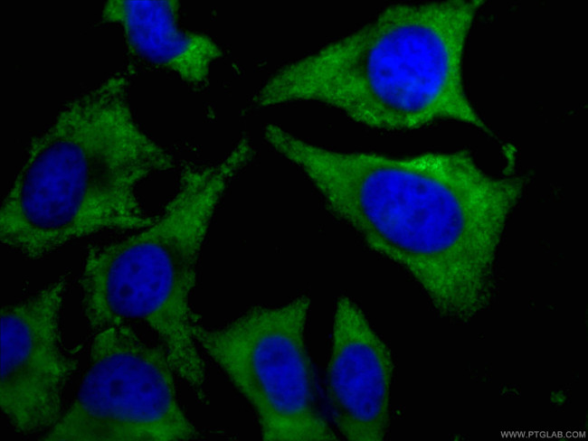 CAPRIN1 Antibody in Immunocytochemistry (ICC/IF)