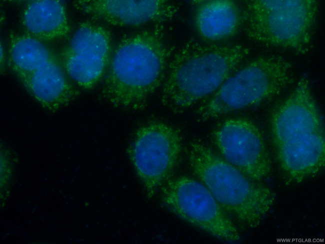 ERp72 Antibody in Immunocytochemistry (ICC/IF)