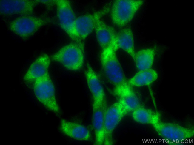 SKAP2 Antibody in Immunocytochemistry (ICC/IF)