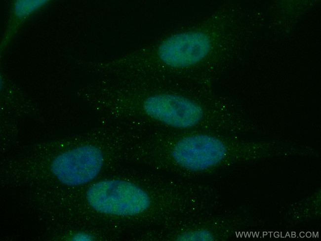 VPRBP Antibody in Immunocytochemistry (ICC/IF)