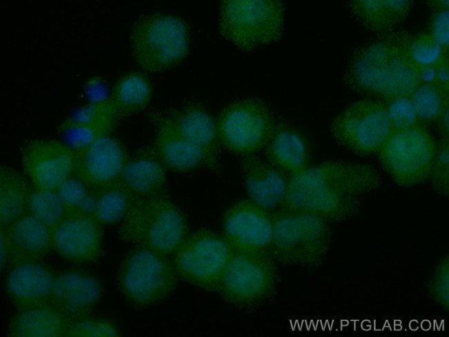 TPRKB Antibody in Immunocytochemistry (ICC/IF)