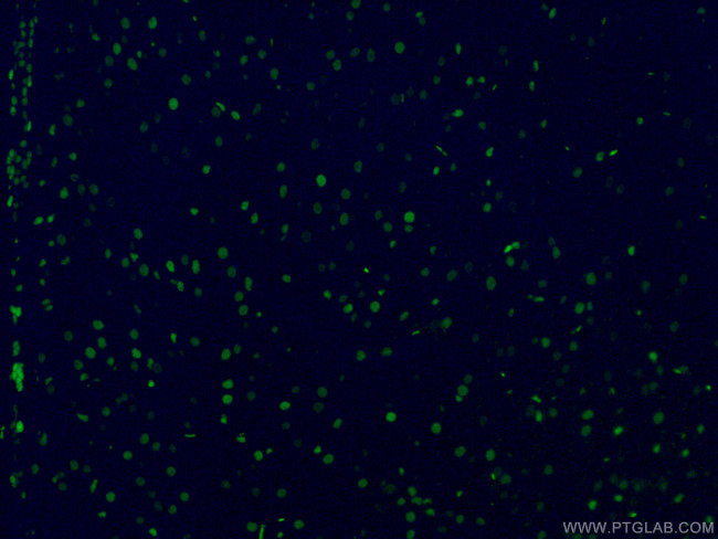 SOX2 Antibody in Immunohistochemistry (PFA fixed) (IHC (PFA))