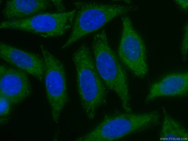 ZC3HAV1 Antibody in Immunocytochemistry (ICC/IF)