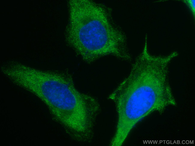 PKC alpha Antibody in Immunocytochemistry (ICC/IF)