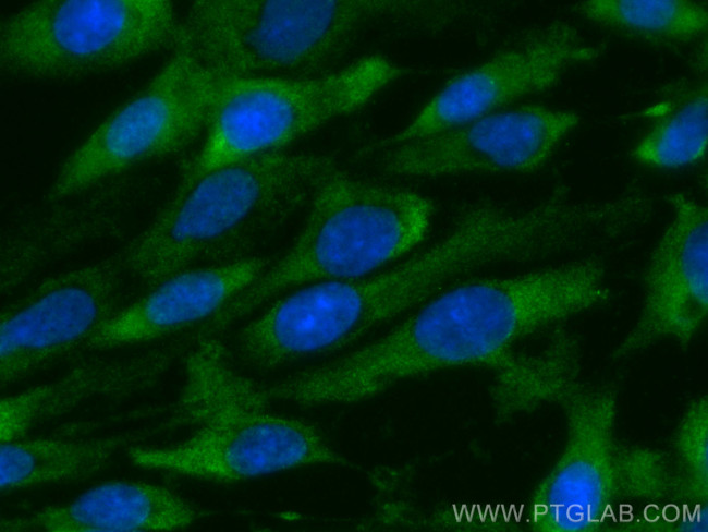 SPARC Antibody in Immunocytochemistry (ICC/IF)