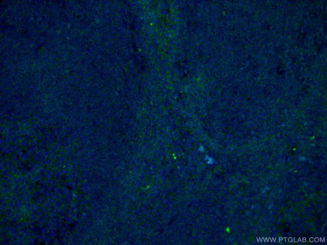 CD147 Antibody in Immunohistochemistry (PFA fixed) (IHC (PFA))