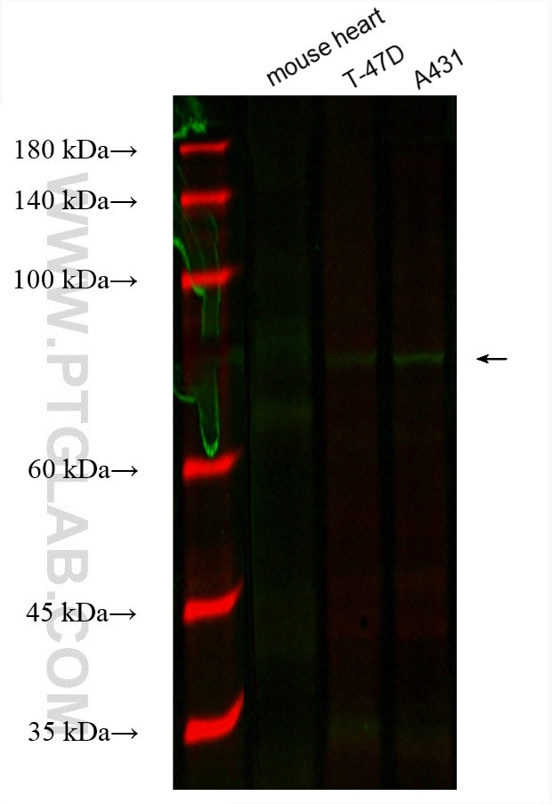 Gamma Catenin Antibody in Western Blot (WB)