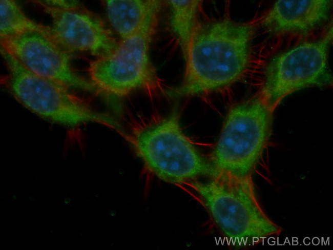 MEA1 Antibody in Immunocytochemistry (ICC/IF)