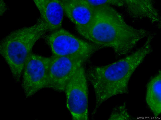 NRG1 Antibody in Immunocytochemistry (ICC/IF)