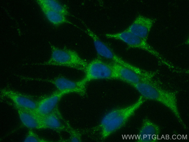 Calretinin Antibody in Immunocytochemistry (ICC/IF)