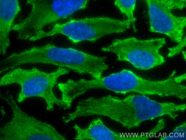 MYPT1 Antibody in Immunocytochemistry (ICC/IF)