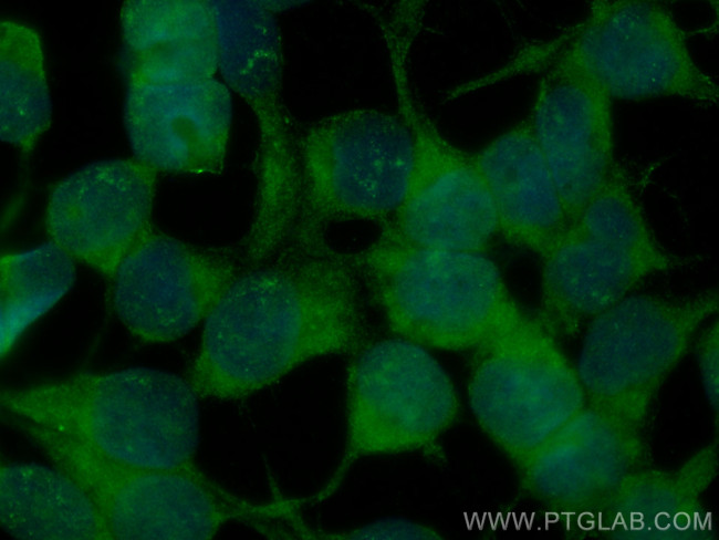 SP1 Antibody in Immunocytochemistry (ICC/IF)