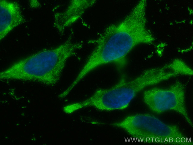 Caspase 2/p32/p18 Antibody in Immunocytochemistry (ICC/IF)