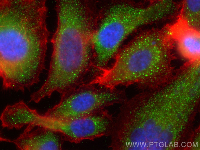 SIAE Antibody in Immunocytochemistry (ICC/IF)