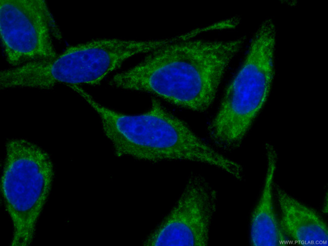 NF-KB p65 Antibody in Immunocytochemistry (ICC/IF)