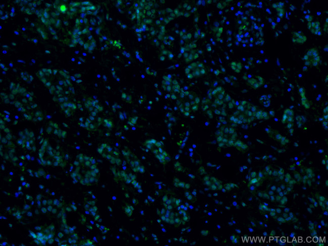 AMPK alpha Antibody in Immunohistochemistry (PFA fixed) (IHC (PFA))