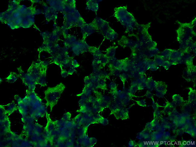 RYR1 Antibody in Immunocytochemistry (ICC/IF)