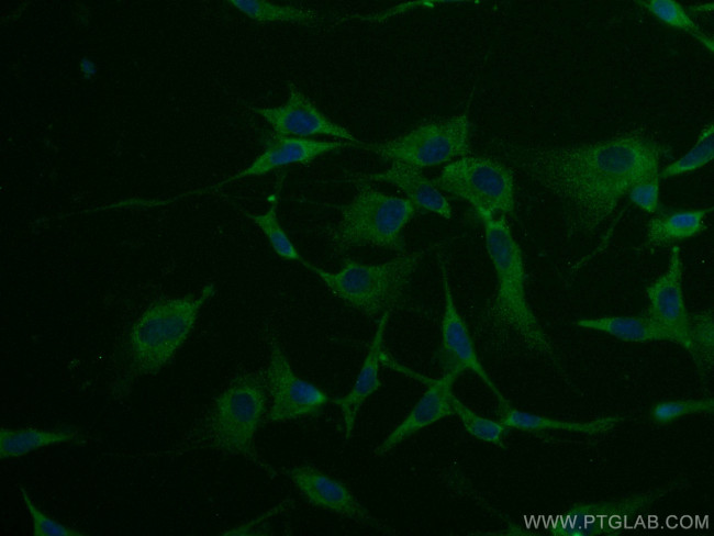 Septin 7 Antibody in Immunocytochemistry (ICC/IF)