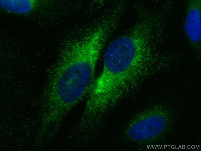 COX4NB Antibody in Immunocytochemistry (ICC/IF)