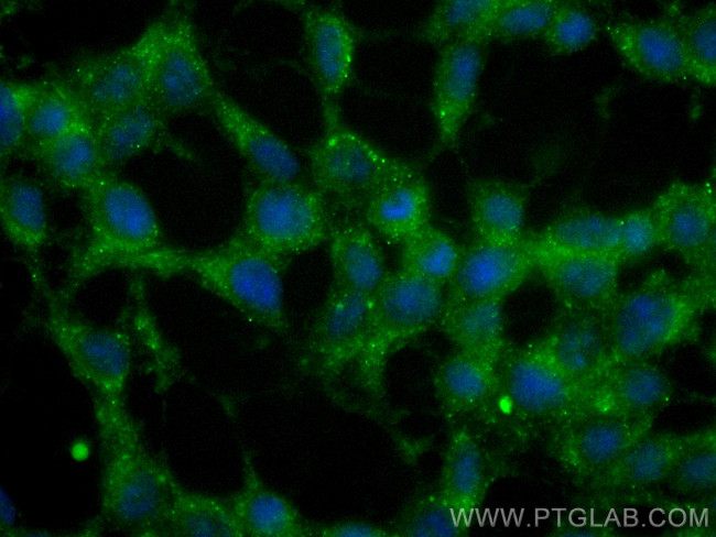 Huntingtin Antibody in Immunocytochemistry (ICC/IF)