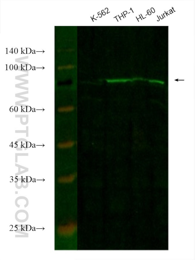 CIN85 Antibody in Western Blot (WB)