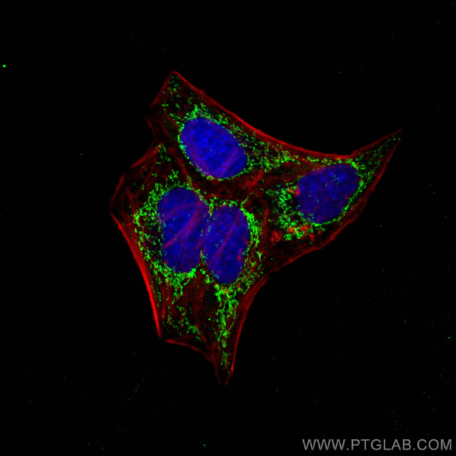 ATPB Antibody in Immunocytochemistry (ICC/IF)