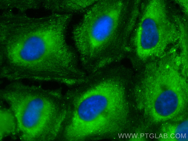RABEPK/p40 Antibody in Immunocytochemistry (ICC/IF)