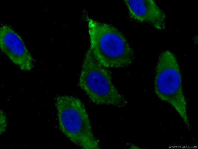 GSTA1 Antibody in Immunocytochemistry (ICC/IF)