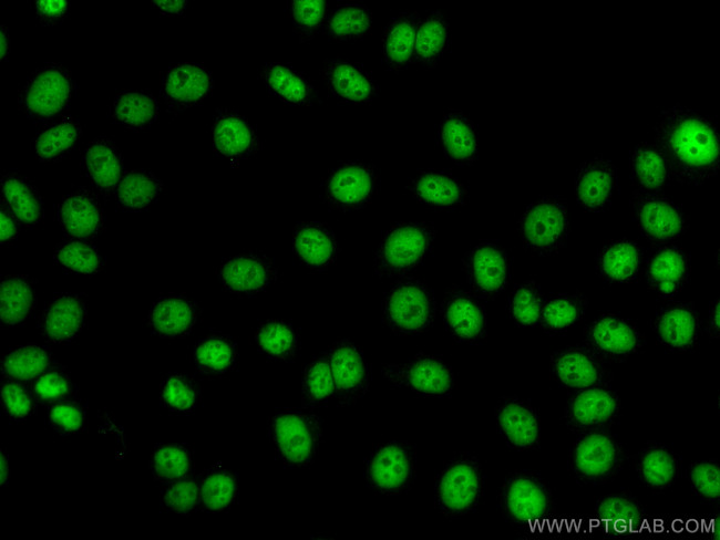 KAP1 Antibody in Immunocytochemistry (ICC/IF)