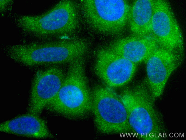 C5 Antibody in Immunocytochemistry (ICC/IF)