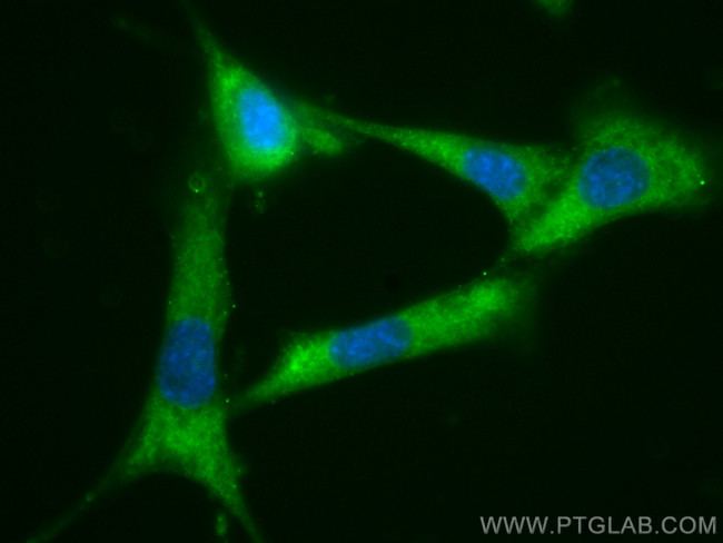 STK3 Antibody in Immunocytochemistry (ICC/IF)