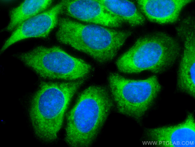 IGFBP2 Antibody in Immunocytochemistry (ICC/IF)