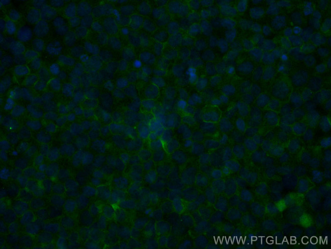 TLR2 Antibody in Immunocytochemistry (ICC/IF)