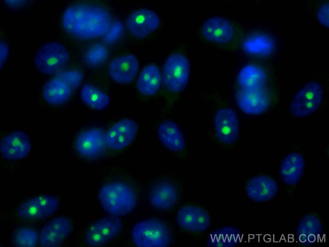 DDX54 Antibody in Immunocytochemistry (ICC/IF)