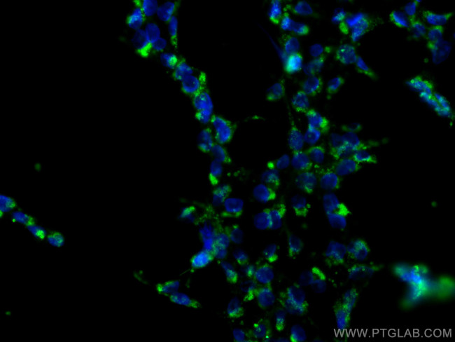 NRBP2 Antibody in Immunocytochemistry (ICC/IF)