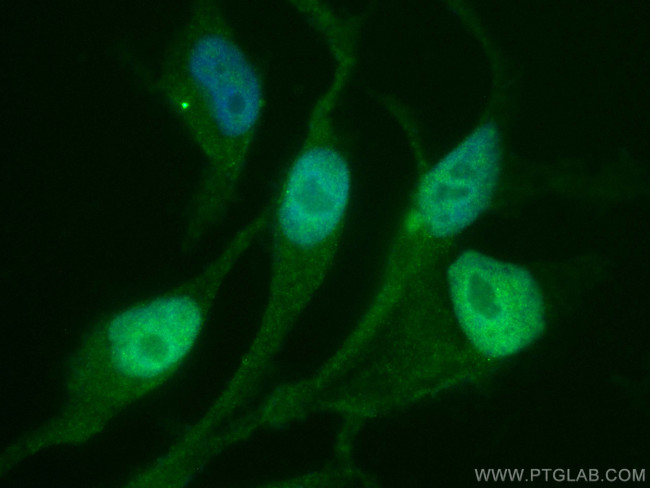 AR Antibody in Immunocytochemistry (ICC/IF)