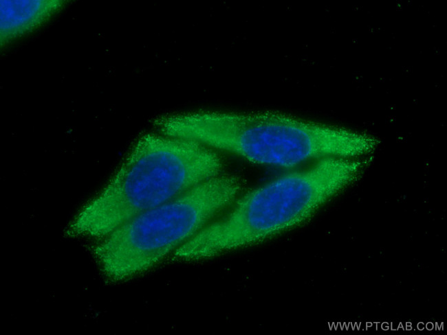 PLA2G4D Antibody in Immunocytochemistry (ICC/IF)