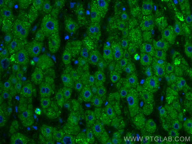Factor X Antibody in Immunohistochemistry (PFA fixed) (IHC (PFA))