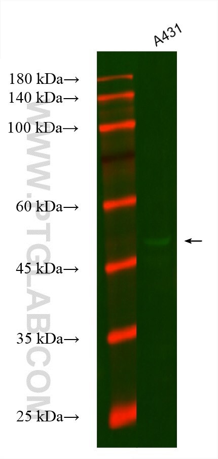 SLC25A1 Antibody in Western Blot (WB)