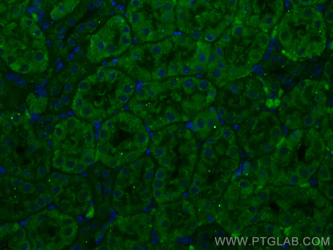 SSTR5 Antibody in Immunohistochemistry (PFA fixed) (IHC (PFA))