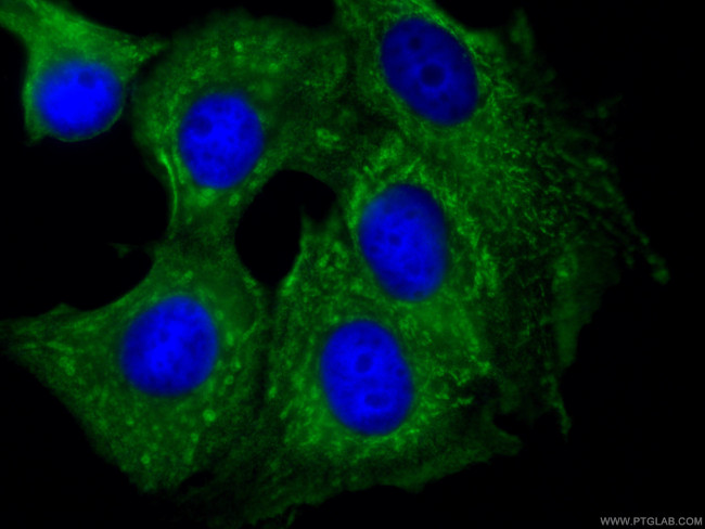 PTPN11 Antibody in Immunocytochemistry (ICC/IF)