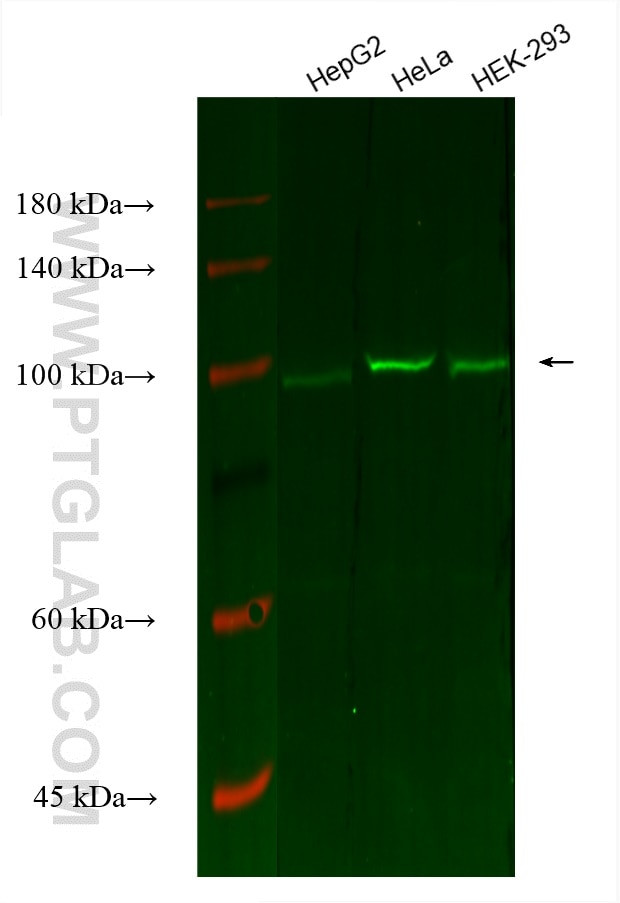 Cytokeratin 16 Antibody in Western Blot (WB)