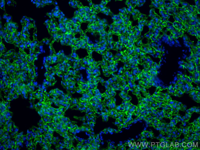 AGER/RAGE Antibody in Immunohistochemistry (PFA fixed) (IHC (PFA))