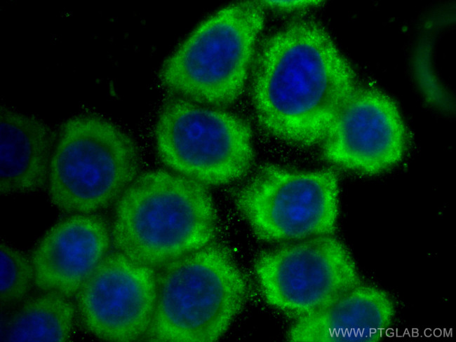 Decorin Antibody in Immunocytochemistry (ICC/IF)