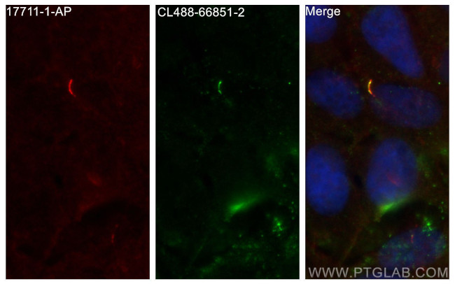SMO Antibody in Immunocytochemistry (ICC/IF)