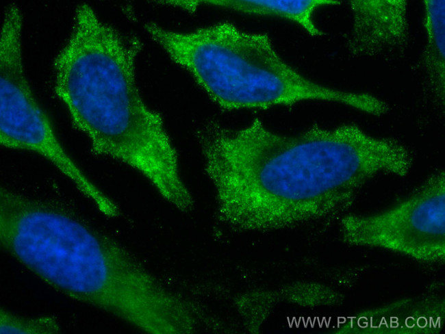 PCK1 Antibody in Immunocytochemistry (ICC/IF)